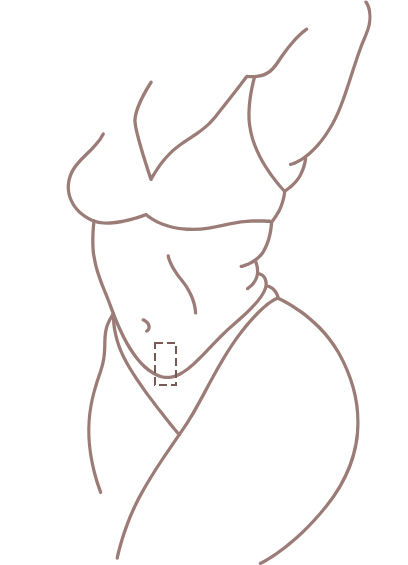 image of the area to be removed from the stomach strip